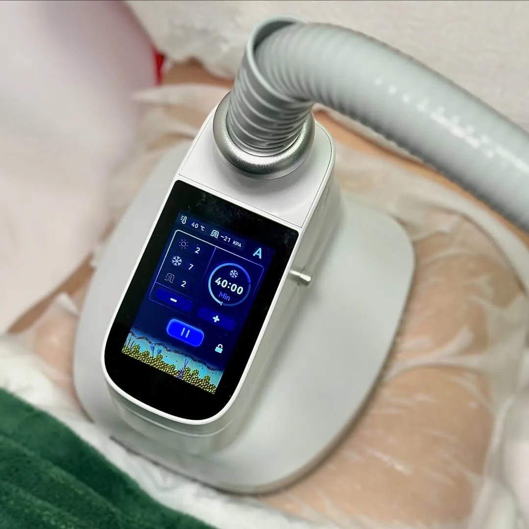 Cryo Ice 360°