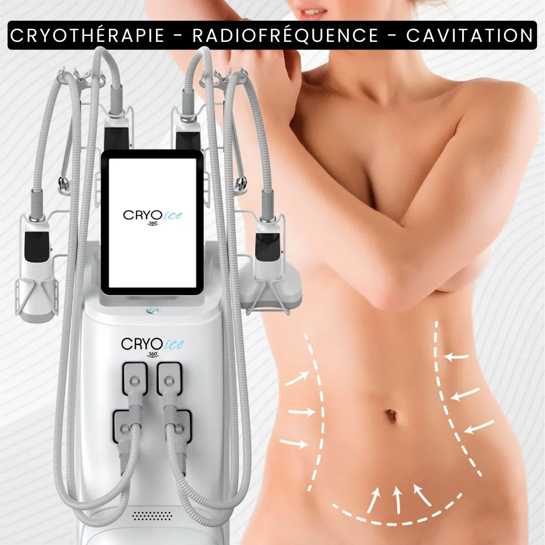 Cryo Ice 360°